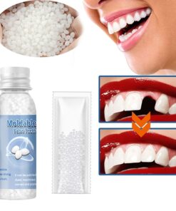 Resin Tooth Repair Glue Shapeable Teeth Gaps Filling Solid Glue Temporary Teeth Repair Falseteeth Glue Safety Dental Supplies