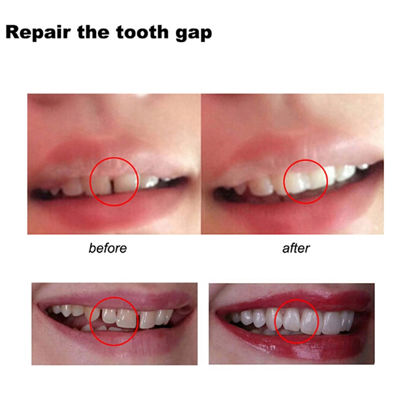 5-80ml Resin Tooth Repair Glue Shapeable Teeth Gaps Filling Solid Temporary Teeth Repair Falseteeth Glue Safety Dental Supplies