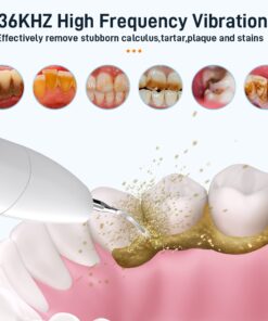 Alternative view of Schoben Ultrasonic Dental Scaler For Teeth Tartar Stain Tooth Calculus Remover Electric Sonic Teeth Plaque Cleaner Stone Removal