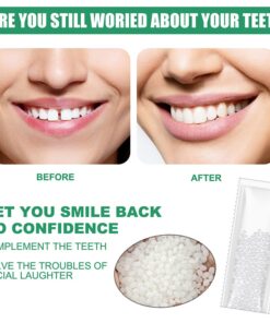 Alternative view of Tooth Repair Filling Glue Resin FalseTeeth Glue Teeth Gap Temporary  Repair Glue Falseteeth Safety Fix Adhesive Dental Supplies